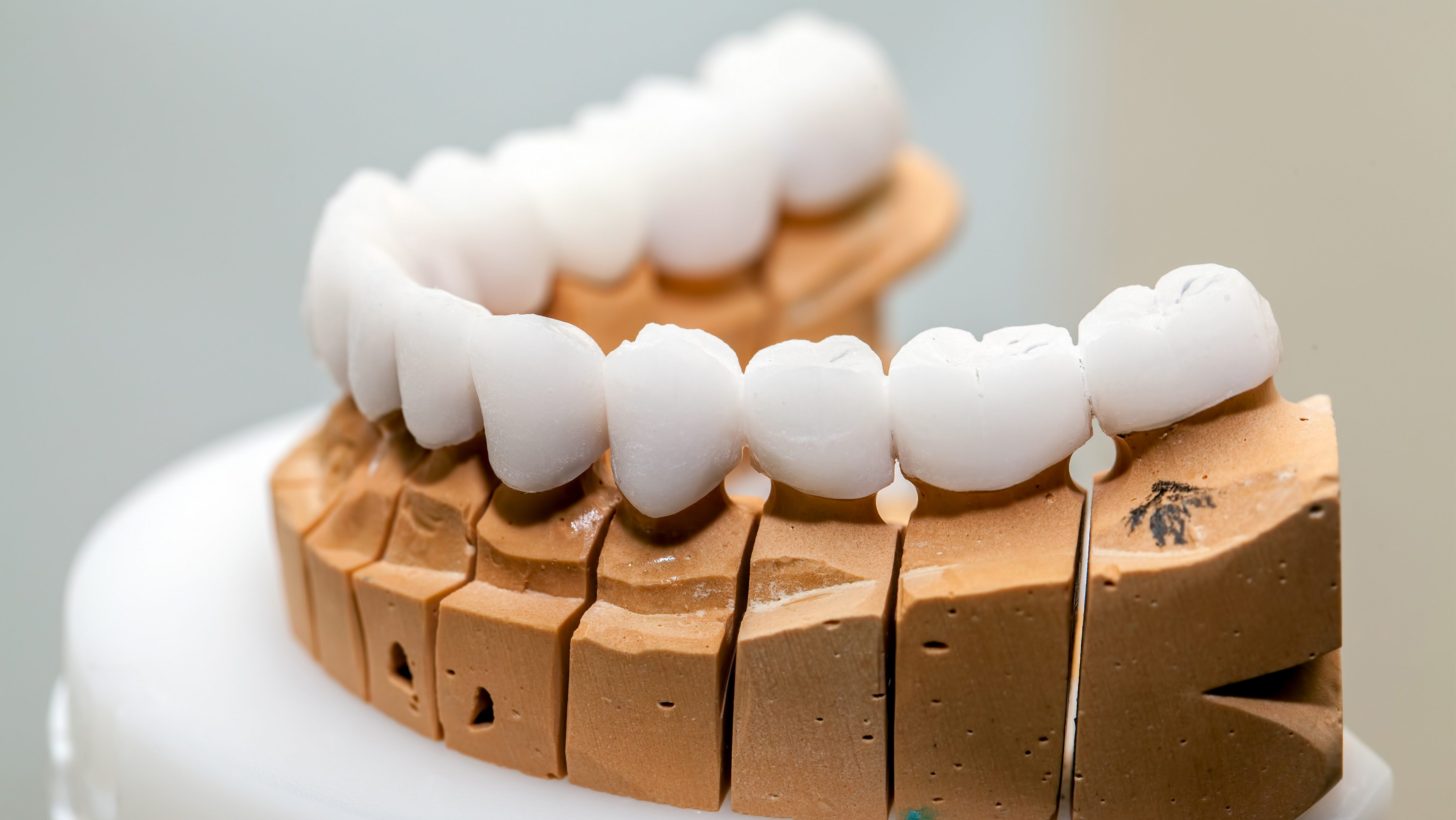 Protetik (Protez) Diş Tedavisi Nedir? Çeşitleri Nelerdir?