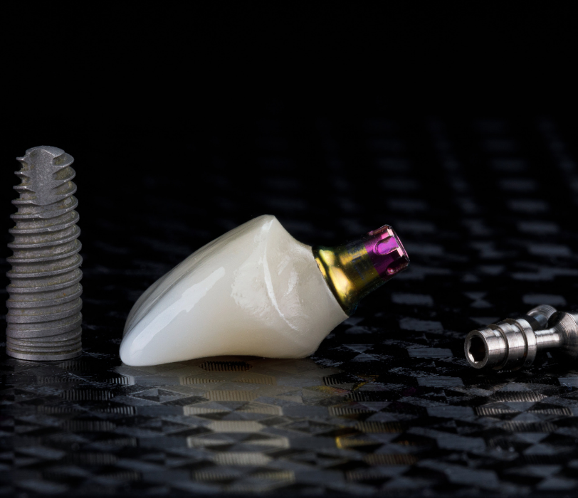 implant tedavisi, İmplant fiyatları, en ucuz İmplant, implant kaç para, diş yaptırma fiyatları