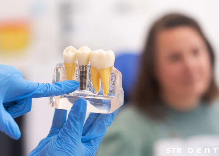 Devlet hastanesi Zirkonyum Diş Kaplama Yapıyor mu?