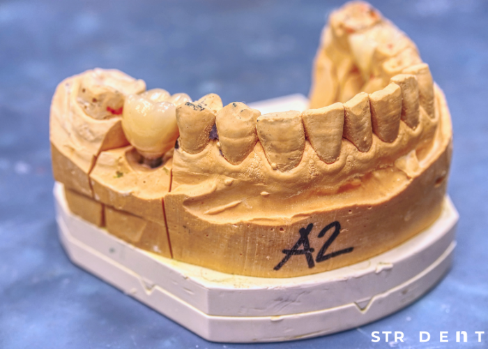 <strong>Zirkonyum Diş Ağız Kokusu</strong>