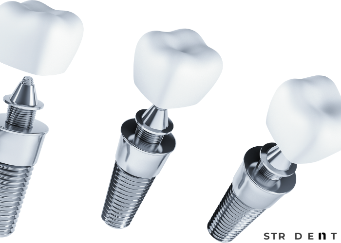 İmplant Diş Yapımı Nasıl Olur?
