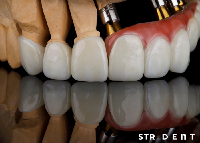 <strong>Kron Kısa Diş Uzatma</strong>