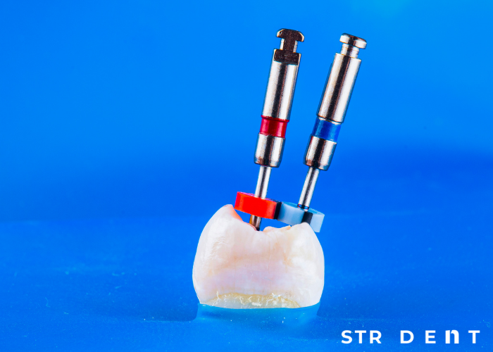 <strong>Kron, Köprü, Kanal ve Diş Dolgusu: Diş Tedavileri Hakkında Bilmeniz Gerekenler</strong>