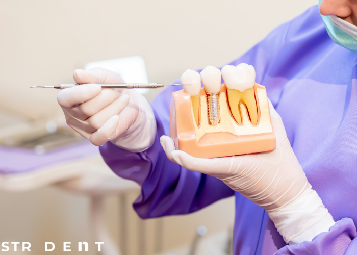 <strong>Diş Eti Estetiği Ekşi</strong>