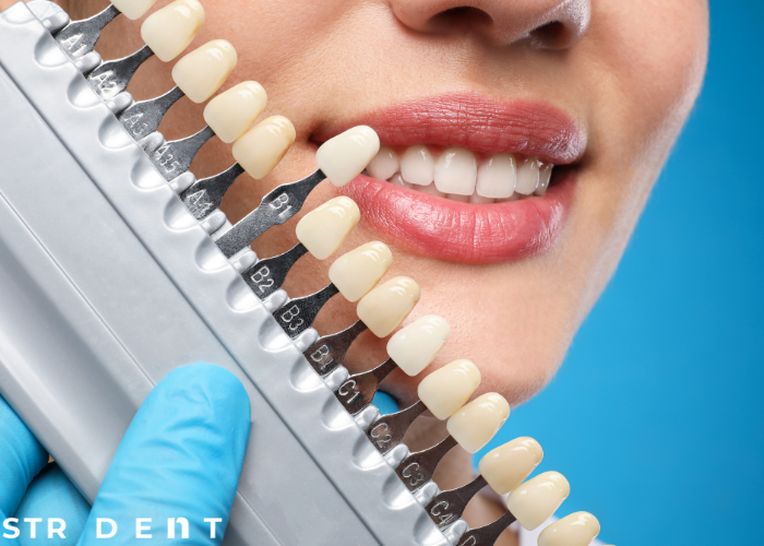 <strong>Estetik Diş Modelleri</strong>