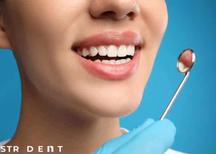 <strong>نماذج أسنان الأرنب الجمالية</strong>