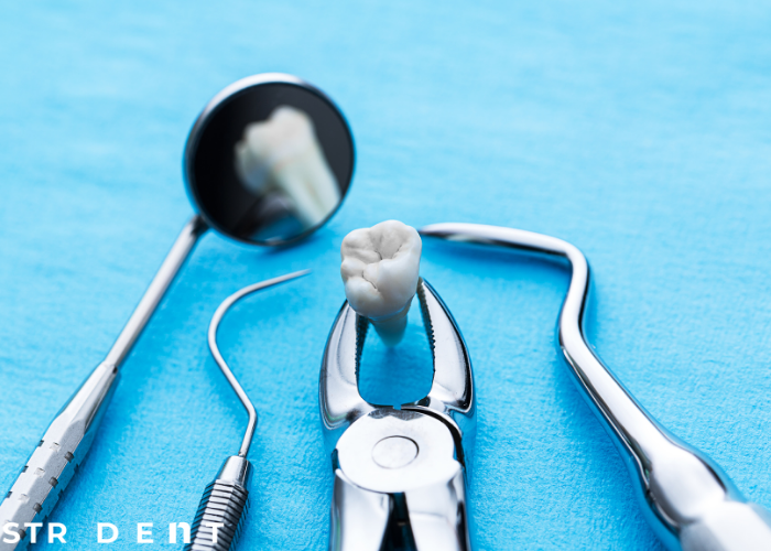 <strong>Ön Dişlere Estetik Dolgu</strong>